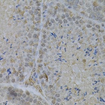 Polyclonal Rabbit anti-Human GLB1 / Beta-Galactosidase Antibody (IHC)