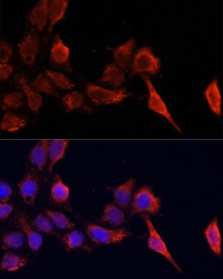 Polyclonal Rabbit anti-Human TIMP1 Antibody (IF)