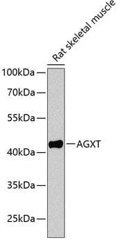 Polyclonal Rabbit anti-Human AGXT / SPT Antibody (WB)