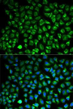 Polyclonal Rabbit anti-Human MAOA / Monoamine Oxidase Antibody (IF)
