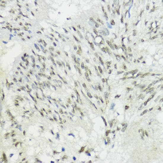 Polyclonal Rabbit anti-Human ZEB1 / AREB6 Antibody (IHC)