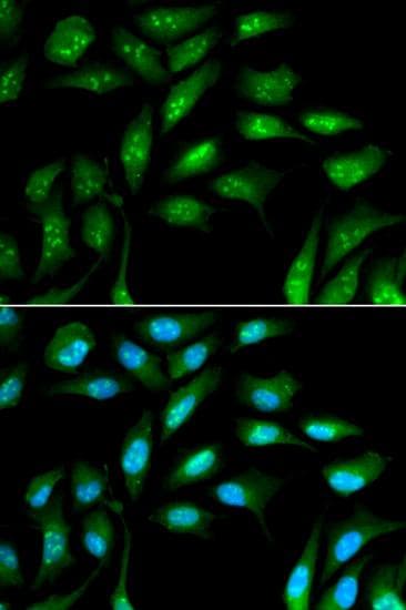B2M / Beta 2 Microglobulin Antibody
