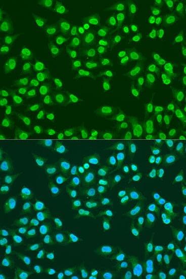 Polyclonal Rabbit anti-Human ATM Antibody (IF)