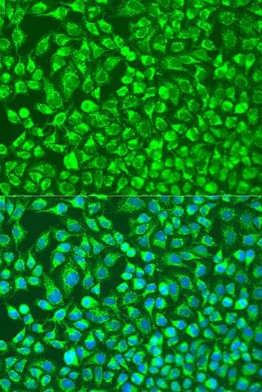 Polyclonal Rabbit anti-Human MMP14 Antibody (IF)