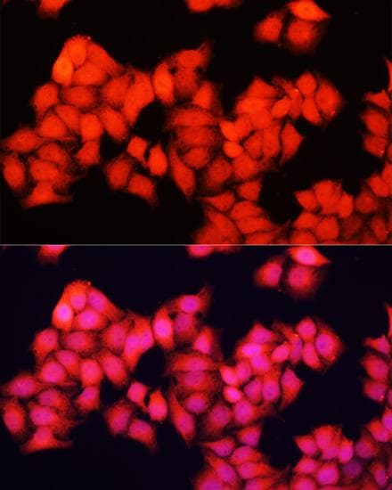 Polyclonal Rabbit anti-Human ARAF / ARAF1 / A-RAF Antibody (IF)