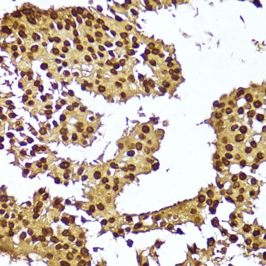 Polyclonal Rabbit anti-Human TERT / Telomerase Antibody (IHC)