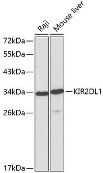 Polyclonal Rabbit anti-Human KIR2DL1 / CD158a Antibody (WB)