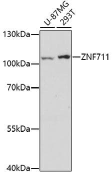 Polyclonal Rabbit anti-Human ZNF711 Antibody (WB)
