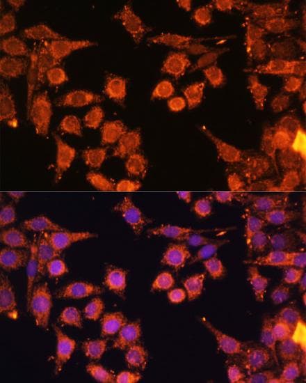 Polyclonal Rabbit anti-Human PRKAA1 + PRKAA2 Antibody (IF)