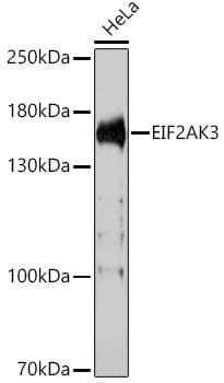 Polyclonal Rabbit anti-Human EIF2AK3 / PERK Antibody (WB)