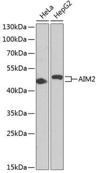 Polyclonal Rabbit anti-Human AIM2 Antibody (WB)