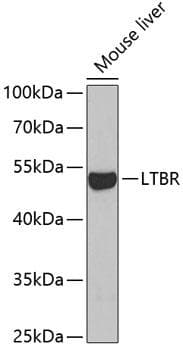 Polyclonal Rabbit anti-Human LTBR Antibody (WB)