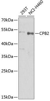 Polyclonal Rabbit anti-Human CPB2 / TAFI Antibody (WB)