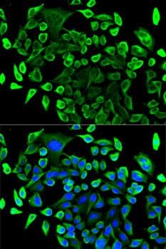 Polyclonal Rabbit anti-Human TAB1 Antibody (IF)