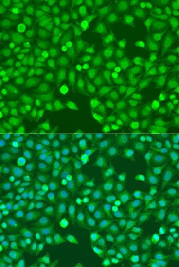 Polyclonal Rabbit anti-Human MEF2A / MEF2 Antibody (IF)