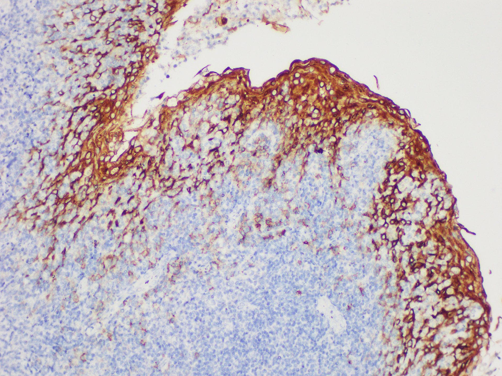 Monoclonal Mouse anti-Human EMA / MUC1 Antibody (IHC)