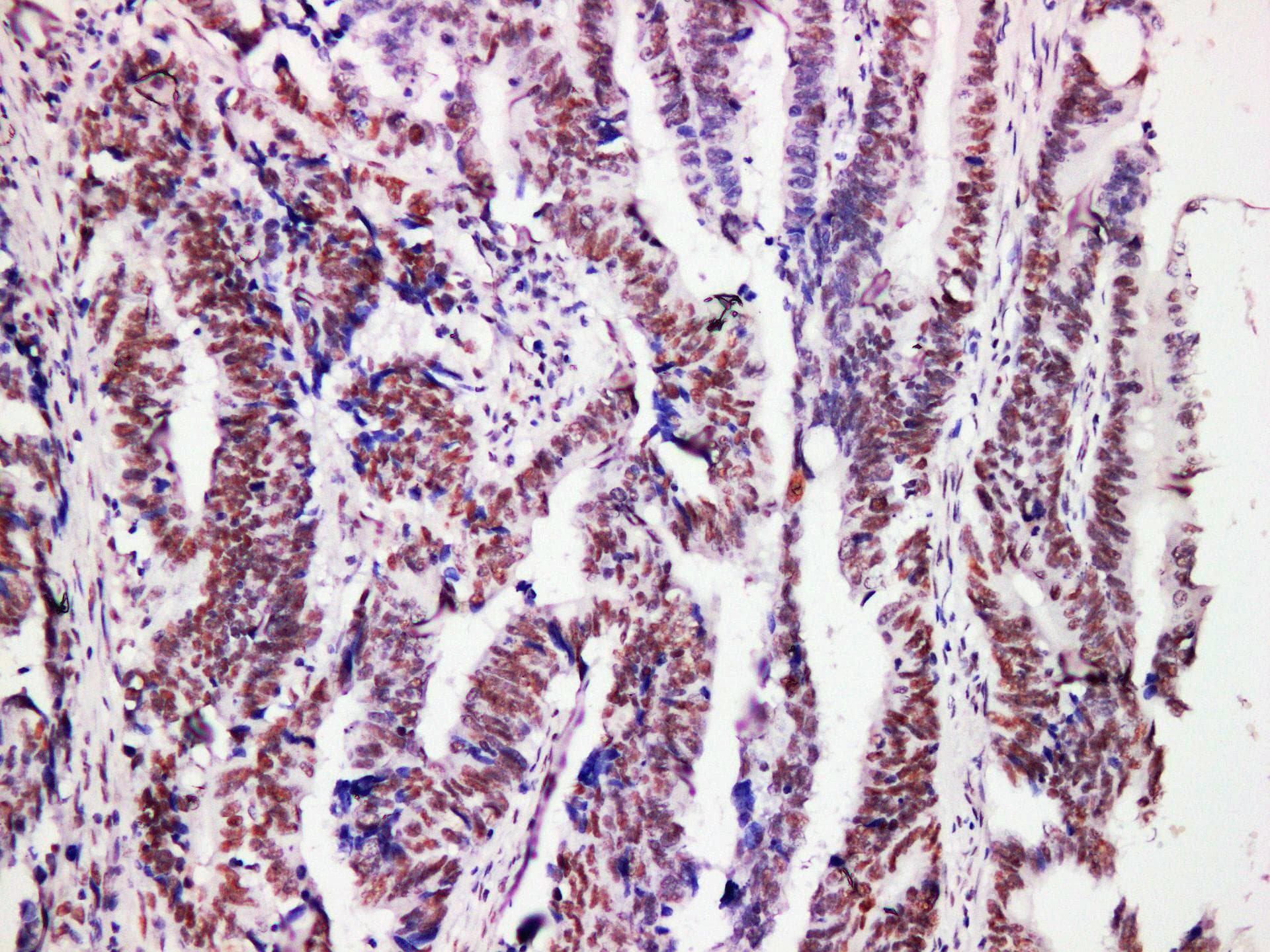 Monoclonal Mouse anti-Human MLH1 Antibody (IHC)
