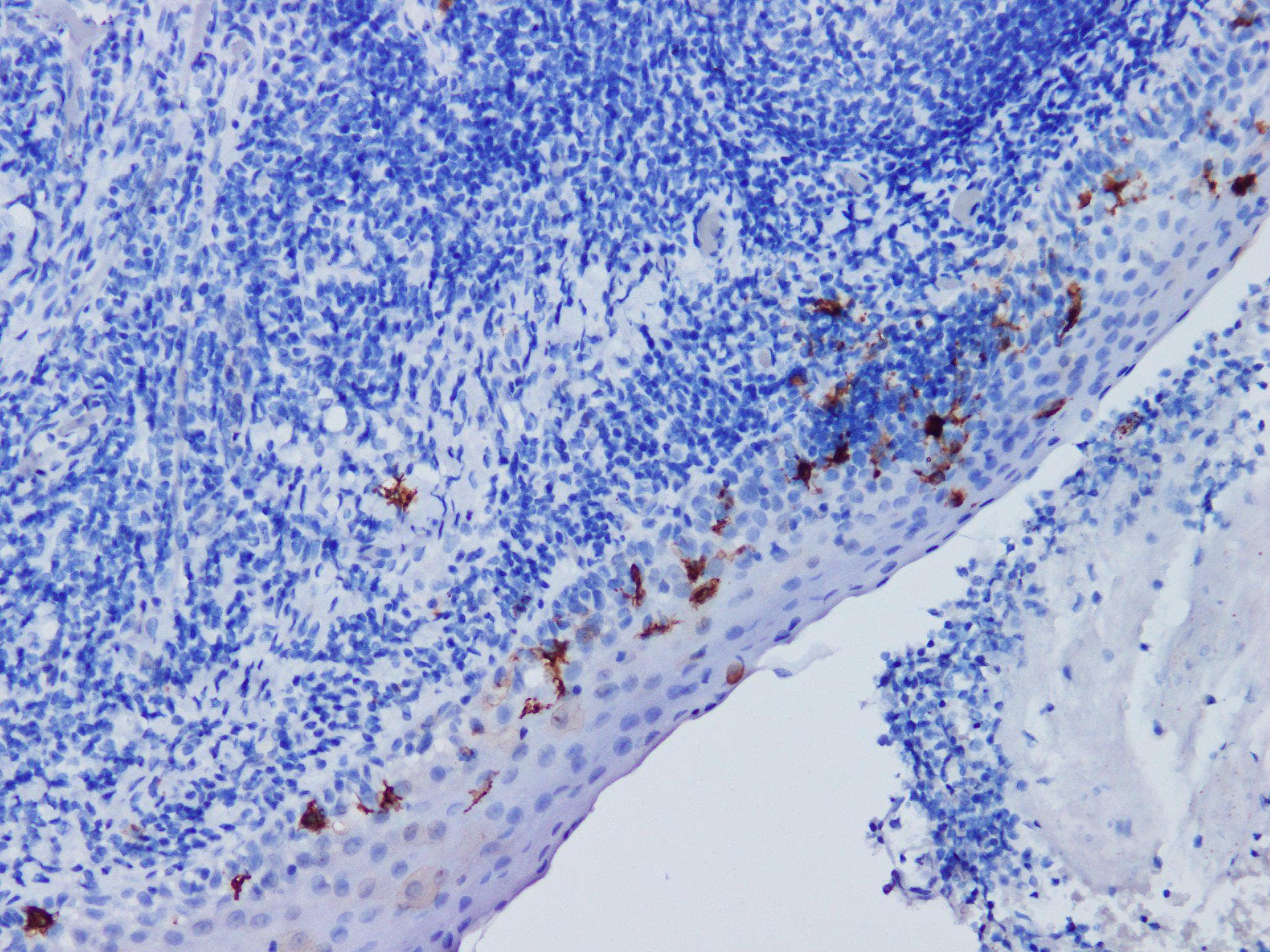 Monoclonal Mouse anti-Human CD1A Antibody (IHC)