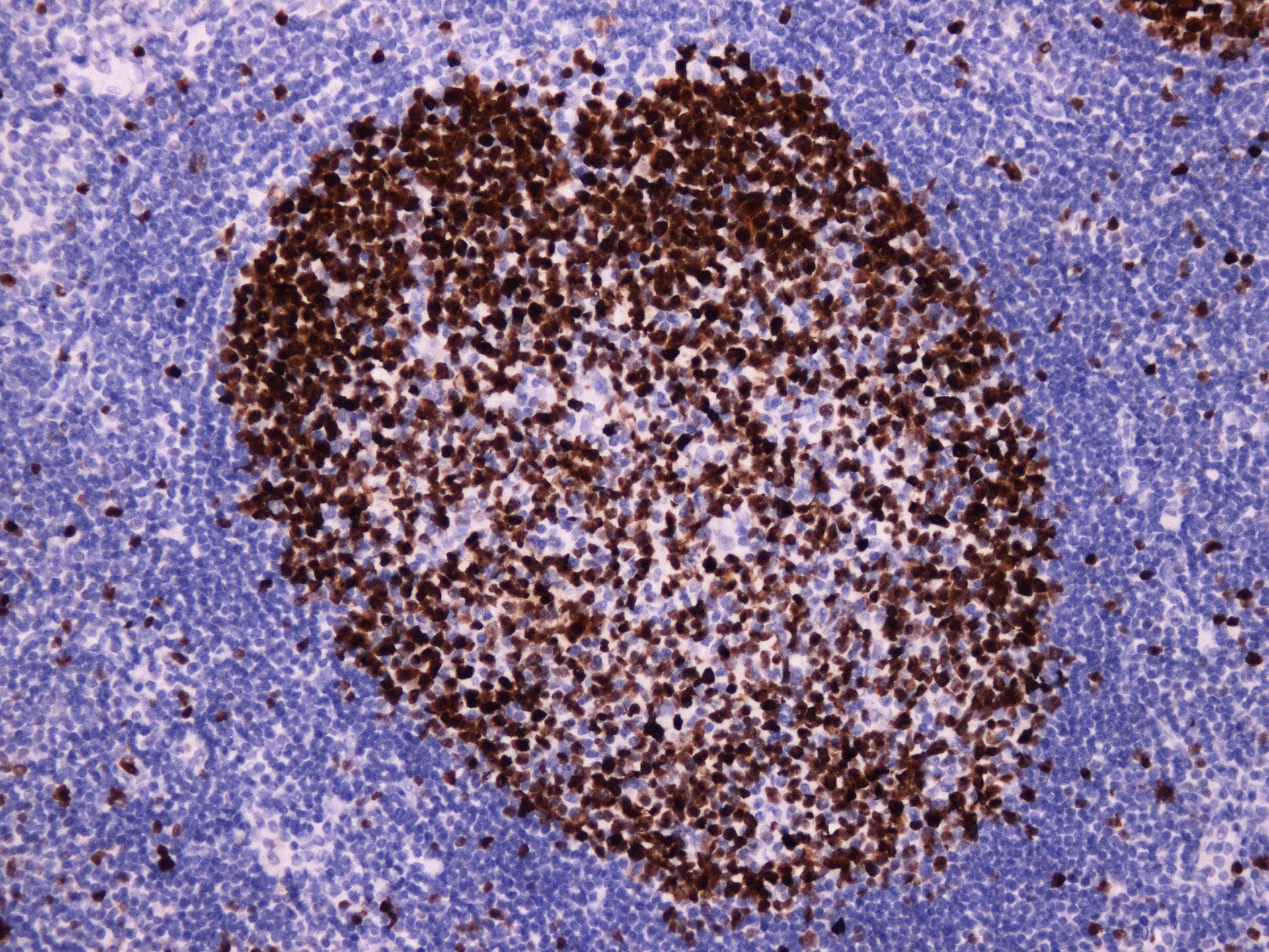 Monoclonal Rabbit anti-Human MKI67 / Ki67 Antibody (IHC)