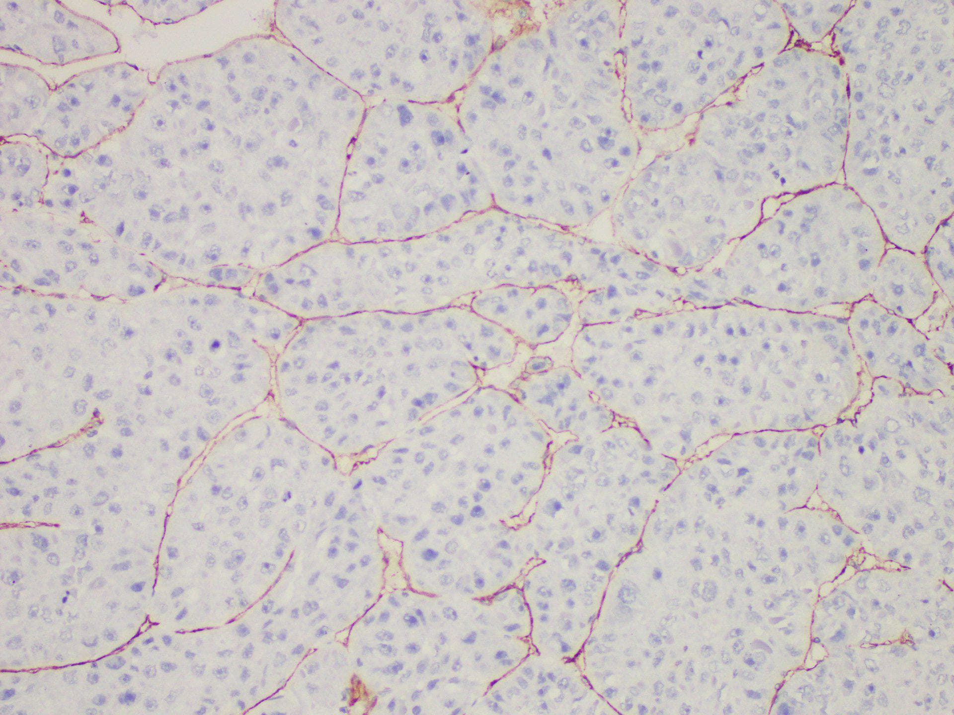 Monoclonal Mouse anti-Human CD34 Antibody (IHC)