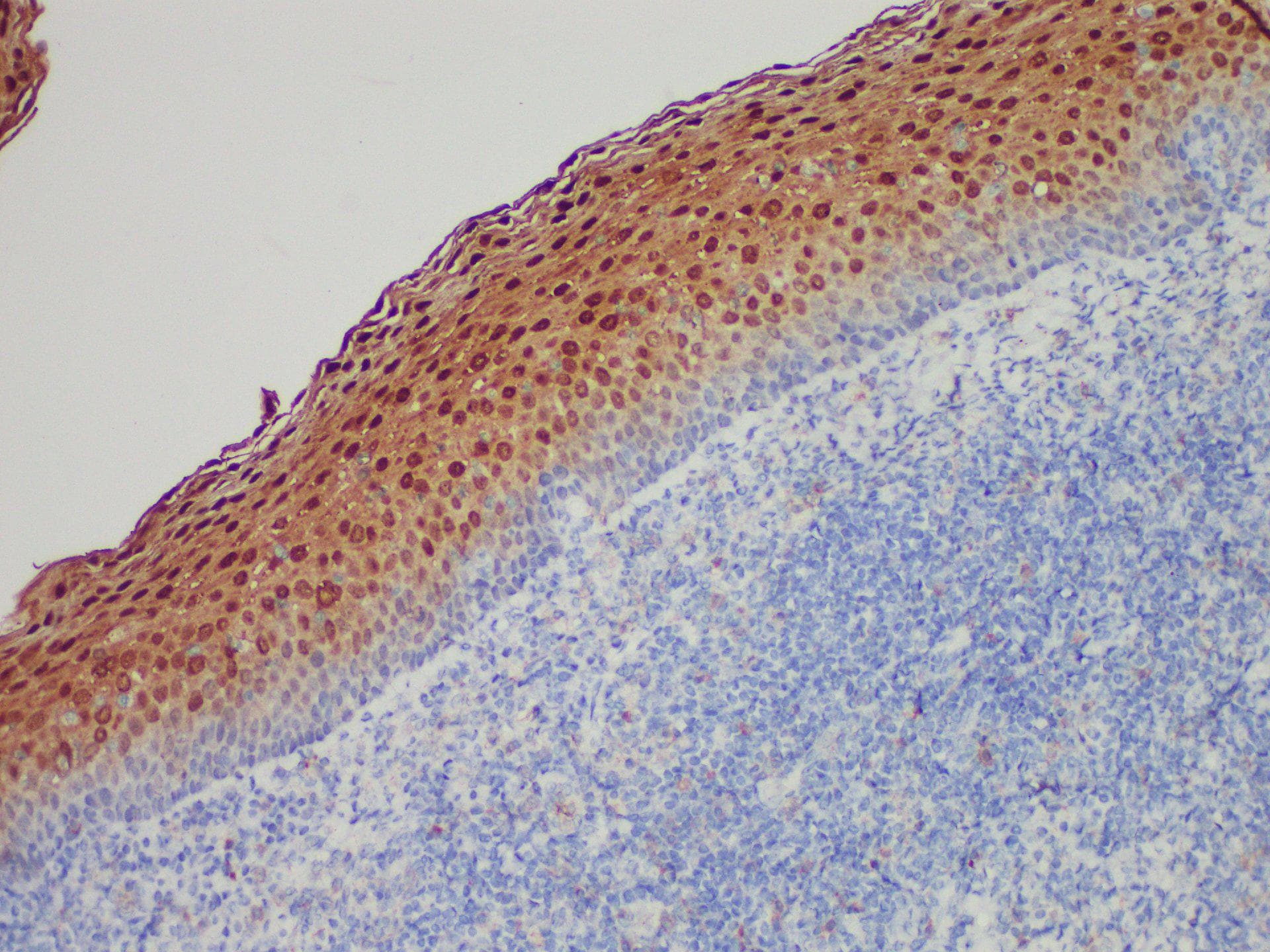 Monoclonal Mouse anti-Human ANXA1 / Annexin A1 Antibody (IHC)