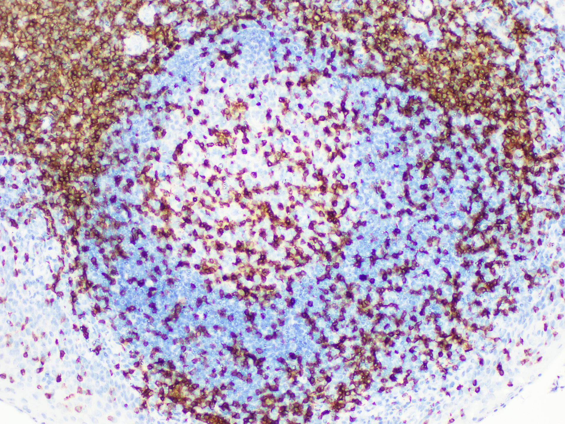 Monoclonal Rabbit CD3 Antibody (IHC)