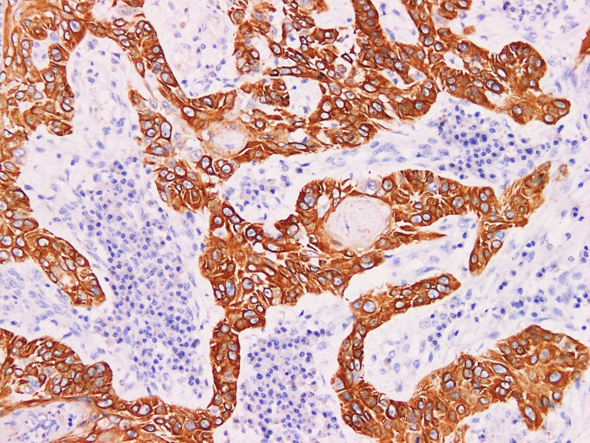 Monoclonal Mouse anti-Human KRT5 / CK5 / Cytokeratin 5 Antibody (IHC)