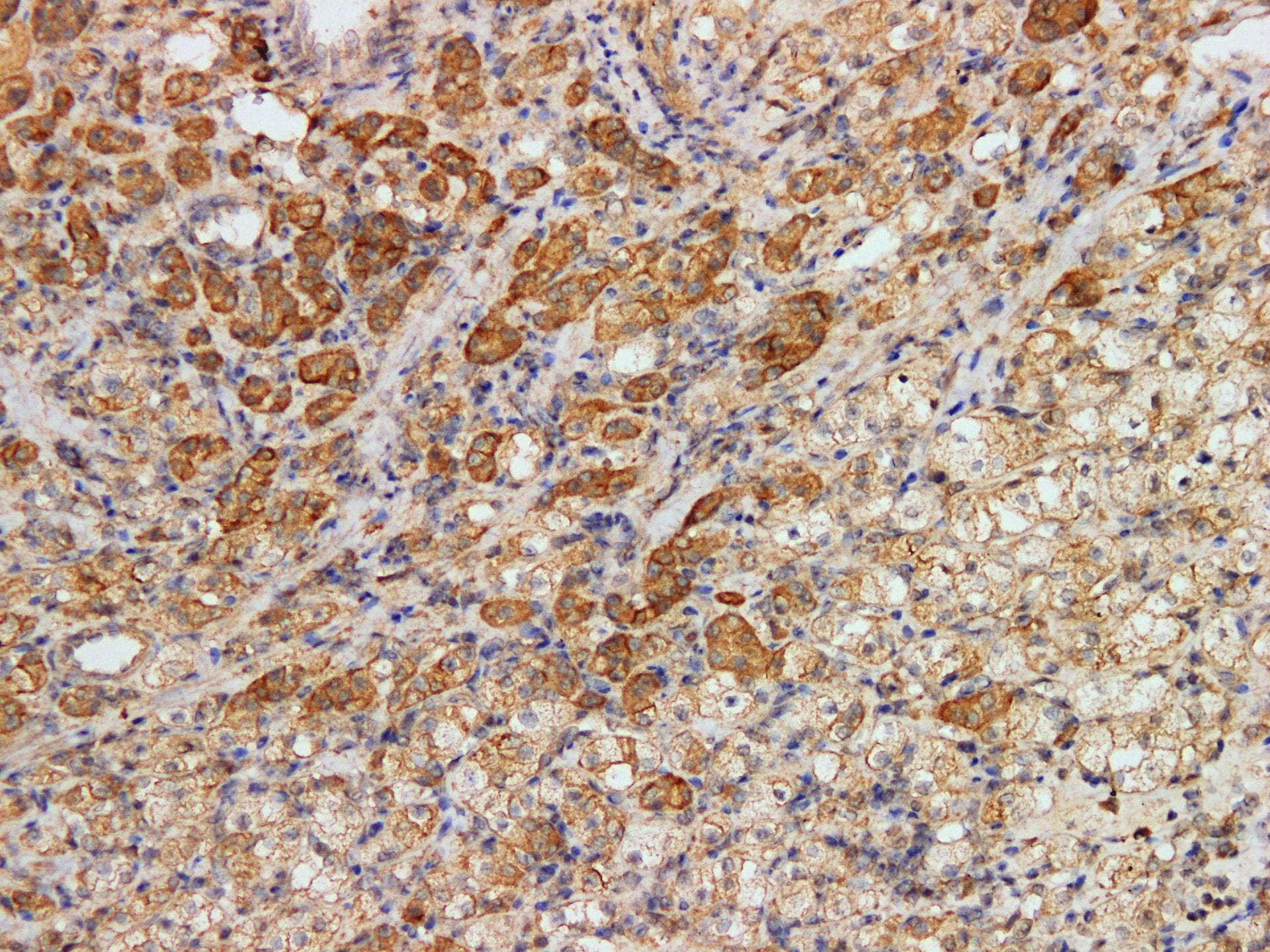 Monoclonal Mouse anti-Human CDH16 / Cadherin 16 Antibody (IHC)