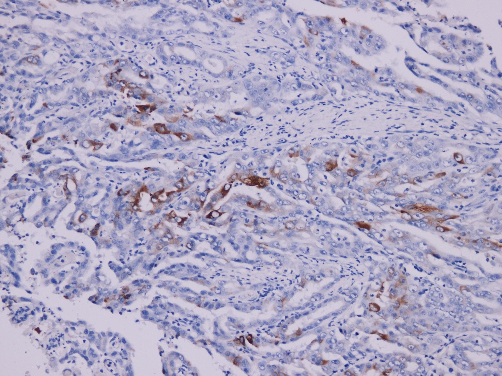 Monoclonal Mouse anti-Human PTGS2 / COX2 / COX-2 Antibody (IHC)