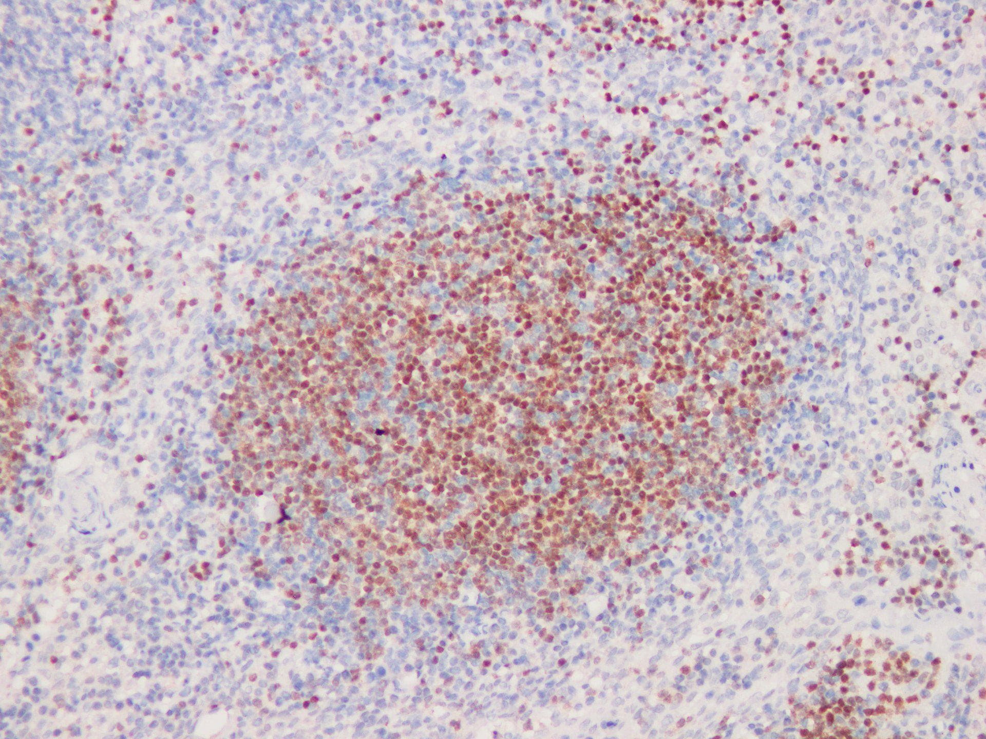 Monoclonal Mouse anti-Human PAX5 Antibody (IHC)