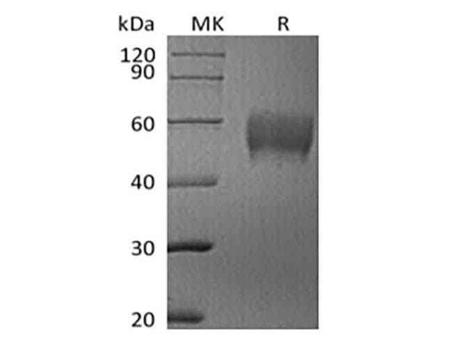 Human SIGLEC7 / CD328 Protein (Recombinant 6His, C-terminus)
