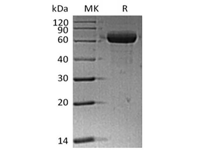 Human ANGPTL4 Protein (Recombinant Fc, C-terminus)