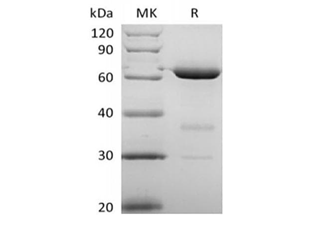 Human NT5E / eNT / CD73 Protein (Recombinant 6His, C-terminus)