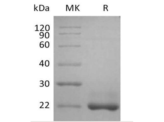 Human BAFF / TNFSF13B Protein (Recombinant 6His, N-terminus)