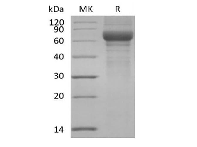 Human VTN / Vitronectin Protein (Recombinant 6His, C-terminus)