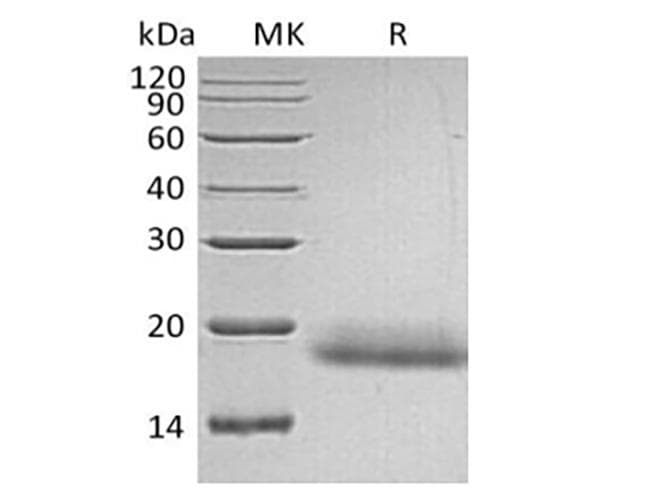 Human CD99 Protein (Recombinant 6His, C-terminus)