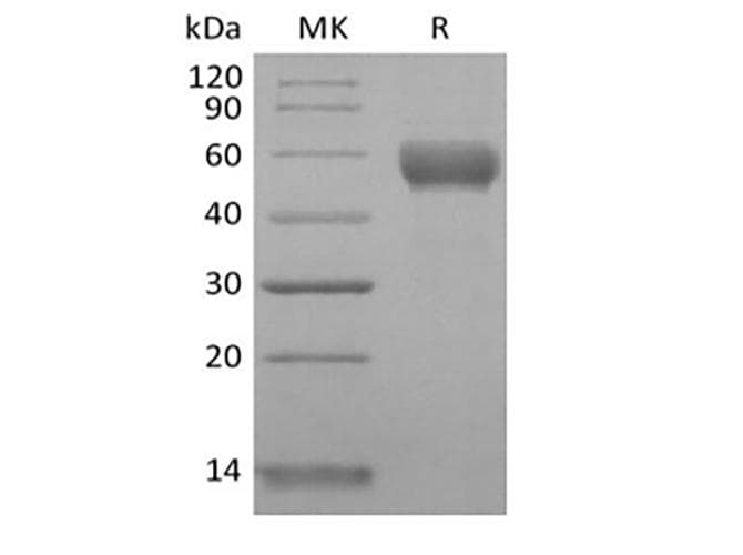 Human CD79B / CD79 Beta Protein (Recombinant Fc, C-terminus)
