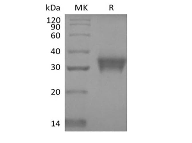 Human STC1 / Stanniocalcin Protein (Recombinant 6His, C-terminus)