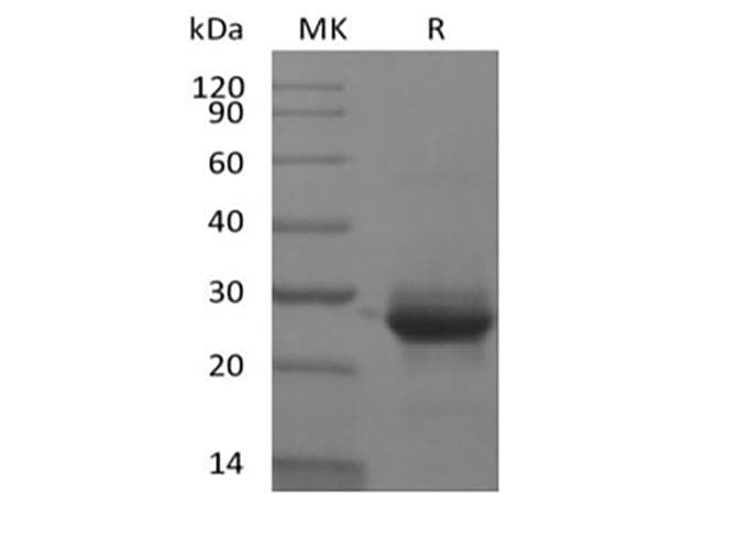 Human KRAS Protein (Recombinant 6His, N-terminus)
