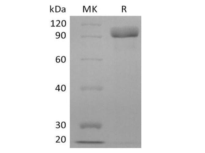 Human ERBB3 / HER3 Protein (Recombinant 6His, C-terminus)