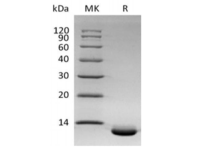 Human CXCL6 Protein (Recombinant 6His, C-terminus)