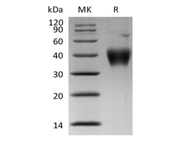 Human CRLF2 / TSLPR Protein (Recombinant 6His, C-terminus)