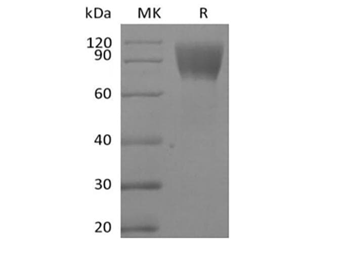 Human CA125 Protein (Recombinant Fc-AVI, C-terminus)