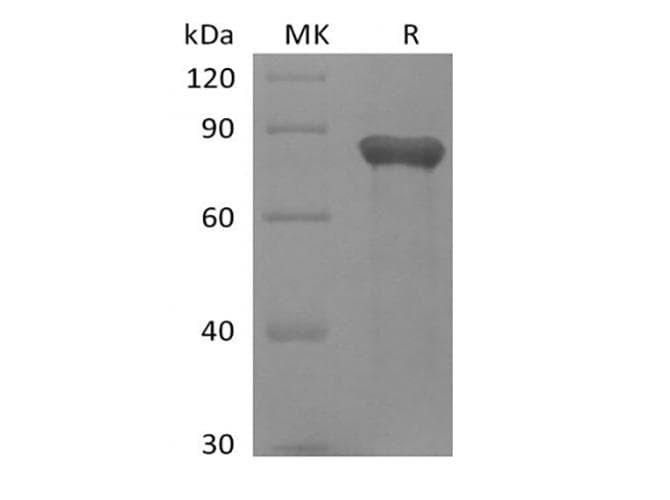 Human GAS6 Protein (Recombinant 6His, C-terminus)