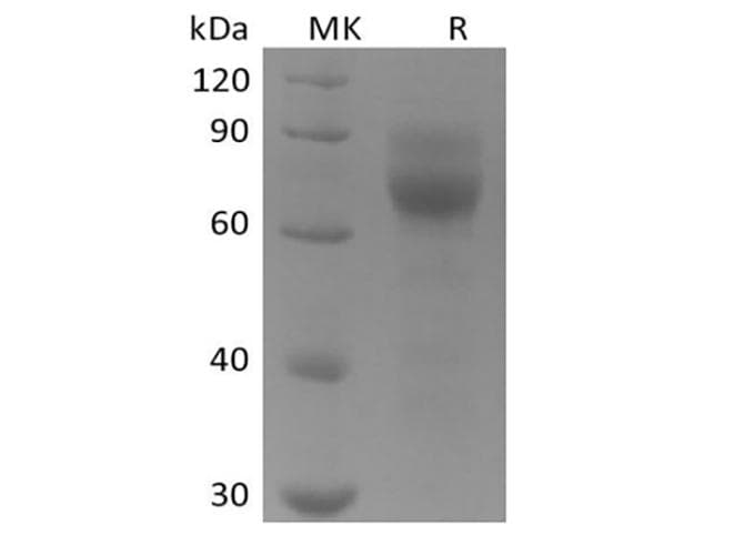 Human AXL Protein (Recombinant 6His, C-terminus)