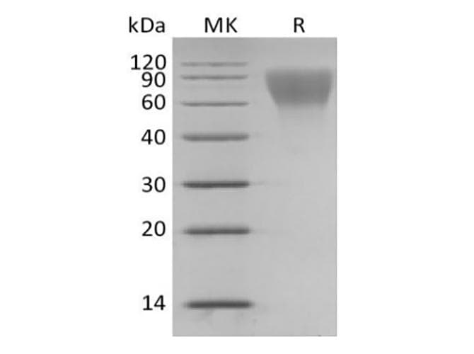 Human CD34 Protein (Recombinant 6His, C-terminus)