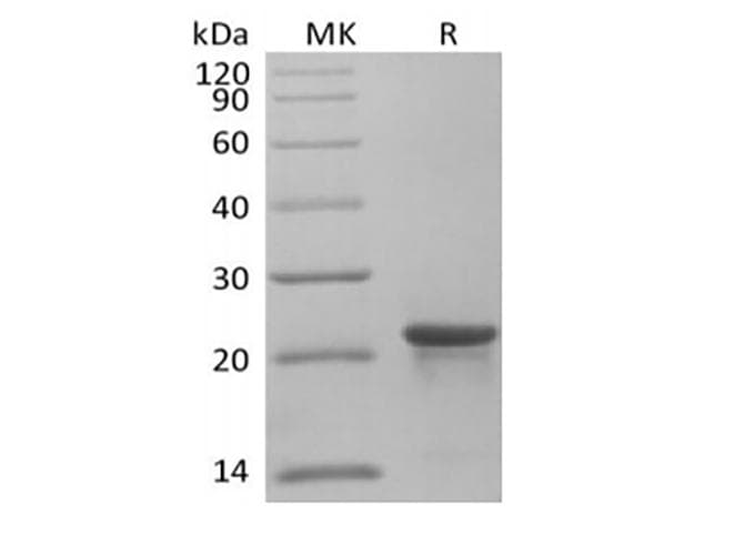 Human KRAS Protein (Recombinant 6His, N-terminus)