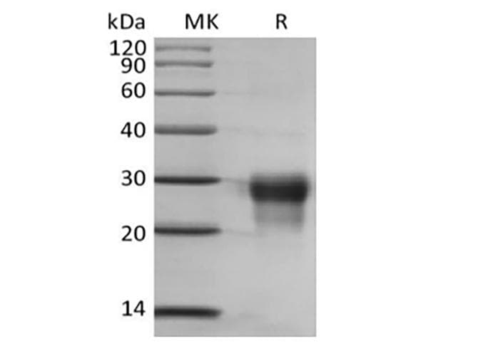 Human PGF / PLGF Protein (Recombinant 6His, C-terminus)
