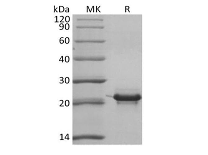 Human KRAS Protein (Recombinant 6His, N-terminus)