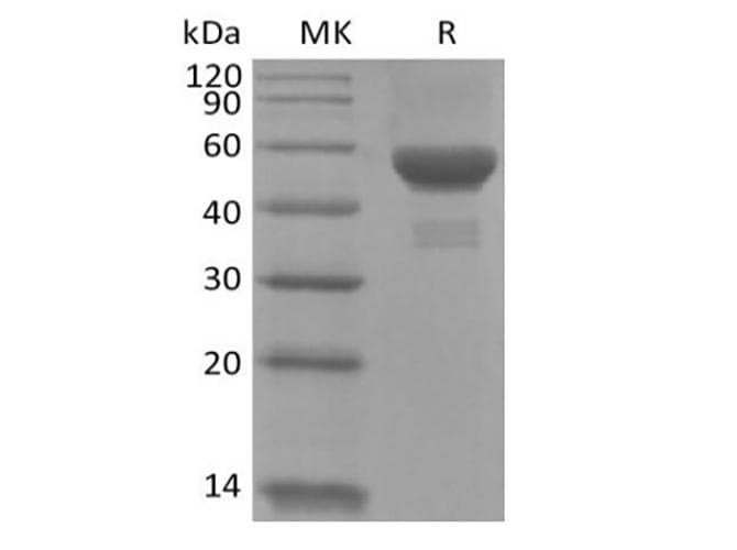 Human CA9 / Carbonic Anhydrase IX Protein (Recombinant 6His, C-terminus)
